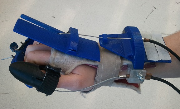 Robo Rehab Project Image 2